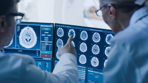 doctors reviewing MRI of brain injury